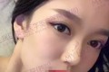 四川美萊醫(yī)學美容醫(yī)院做雙眼皮哪個醫(yī)生比較好