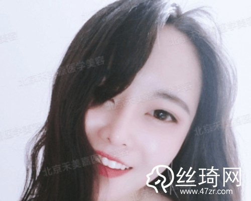 北京禾美嘉醫(yī)療美容自體脂肪填充面部那個(gè)醫(yī)生好？