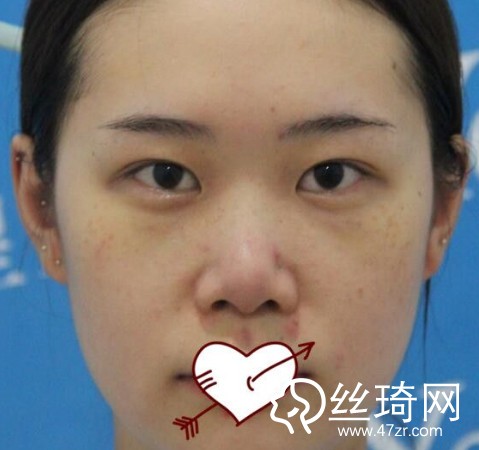 成都恒博醫(yī)院李烈醫(yī)生怎么樣？