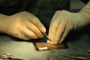 玻尿酸隆鼻也有被嫌棄的時(shí)候，你該怎么選?