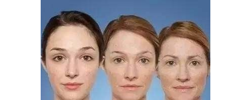 面部年輕化，多方面進(jìn)入時(shí)代