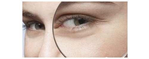 去魚(yú)尾紋要多少錢，去魚(yú)尾紋價(jià)格貴不貴