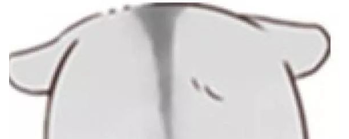 顴骨寬大，選擇顴弓內(nèi)推還是脂肪填充？哪個能讓臉變小