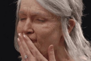 ?抗衰還得靠注射除皺!皺紋形成原因？