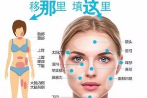 自體脂肪填充，將脂肪變廢為寶！自體脂肪的成活率高嗎