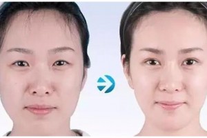 重慶鵬愛醫(yī)療美容醫(yī)院全新價(jià)格表