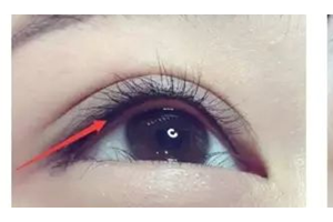 做美瞳線，疼不疼？半永.久美瞳線優(yōu)勢(shì)有哪些