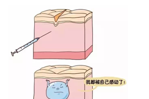 成都玻尿酸豐唇要多少錢 成都市玻尿酸豐唇價(jià)格表