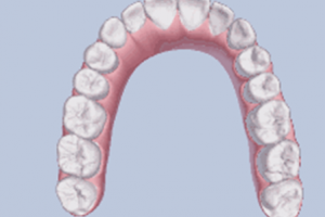 牙齒矯正，要多久? 我32歲可以做矯正嗎？