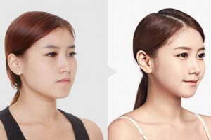 南寧韓成整形醫(yī)院全新價(jià)格表