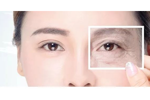 內(nèi)切去眼袋是什么 內(nèi)切去眼袋優(yōu)勢(shì)和適合人群