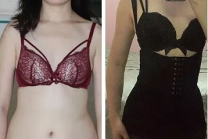 為什么吸脂減肥不容易反彈？只有肥胖者才能吸脂嗎？