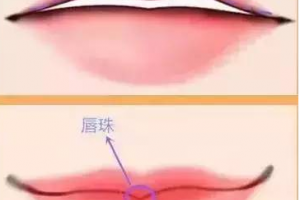 迷死人的微笑唇究竟是怎么做的？玻尿酸豐唇果好不好