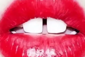 門牙縫大“漏財(cái)”還毀顏值，整形牙科醫(yī)教你2招關(guān)縫納財(cái)！