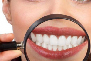 杭州美萊口腔醫(yī)院，口腔知識科普：牙齒美白多少錢一次？