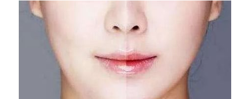 3分鐘，帶你了解醫(yī)美“黑話(huà)”