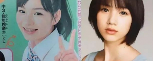 哪些人不適合做開眼角？