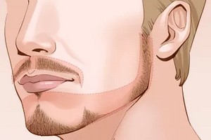 植胡須的果怎么樣?有沒有副作用?