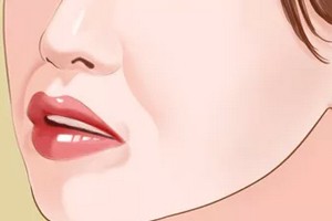 天生法令紋很深怎么辦？