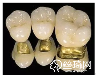 二氧化鋯全瓷冠與金屬烤瓷牙比較哪個(gè)好