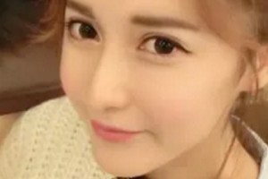 耳軟骨延長(zhǎng)鼻小柱果好不好 多久可以恢復(fù)自然