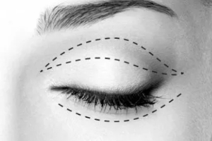 廣州曙光醫(yī)學美容醫(yī)院實力附2019年價格表