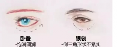 玻尿酸注射『臥蠶』，你需要嗎？