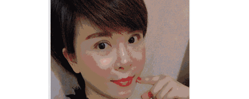 深圳藝星整形醫(yī)生常德成：她脂肪填充后，臉居然變小了？