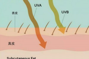 深圳藝星整形醫(yī)生王明海：為什么有些人夏天曬不黑？而你一曬就黑…