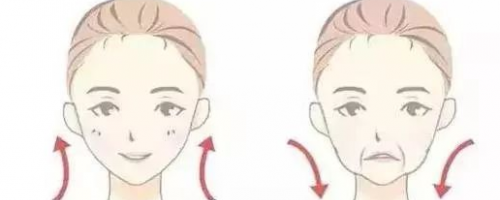 【法令紋】玻尿酸VS埋線提升，去法令紋到底哪個好？