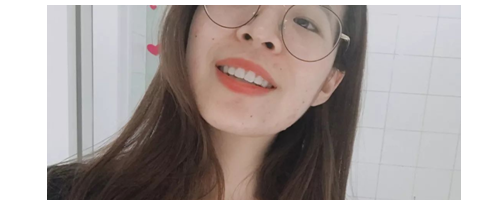 分享一些牙齒矯正的事情，希望能幫到你