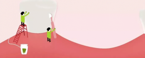 家人不用擔(dān)心我的胃口了！牙齒種植Soeasy！