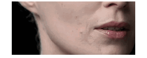 揭開埋線提升秘密，幫你留住仙氣！