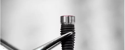 揭秘種植牙內(nèi)幕，種植牙有什么好處？真的是貴嗎？