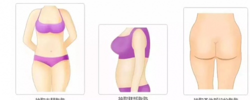 科普你真的了解自體脂肪填充么？