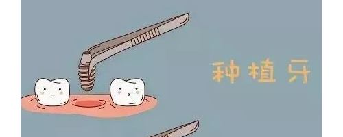 種植牙是在口腔里放一個(gè)“種子”讓牙萌出嗎？