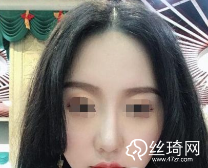 蘭州皙妍麗醫(yī)療美容整形門診部做的瘦臉術(shù)價(jià)格表