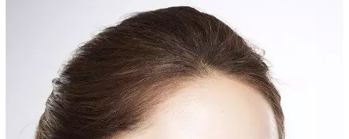 為什么祛斑越祛越多？