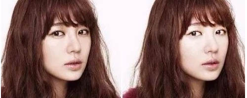 臥蠶與眼袋有什么區(qū)別？為什么臥蠶顯得可愛而眼袋會顯老呢