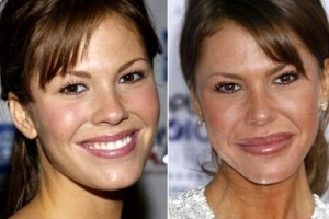 成都恒博醫(yī)院植發(fā)中心怎么樣附全新價(jià)格表(價(jià)目表)