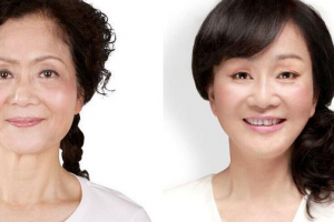 南寧雍禾植發(fā)怎么樣附全新價(jià)格表(價(jià)目表)