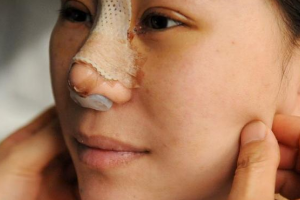 黑龍江瑞麗植發(fā)中心怎么樣附全新價(jià)格表(價(jià)目表)