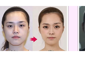 廣西武警總隊(duì)醫(yī)院植發(fā)中心怎么樣附全新價(jià)格表(價(jià)目表)