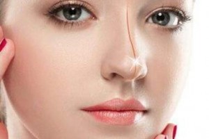 天津市中醫(yī)藥研究院附屬醫(yī)院（長征醫(yī)院）整形皮膚外科整形價格表一覽及醫(yī)院介紹