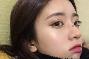 陜西省友誼醫(yī)院整形科整形價(jià)格表一覽及醫(yī)院介紹