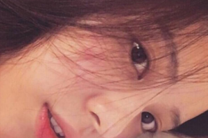 濟(jì)南市皮膚病防治院美容外科整形價格表(價目表)全新發(fā)布