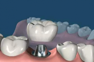 2020沈陽康貝佳口腔門診部整形價格表(價目表)全新發(fā)布