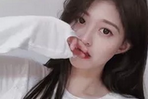 2020長春西之米醫(yī)療美容醫(yī)院整形價格表(價目表)全新發(fā)布