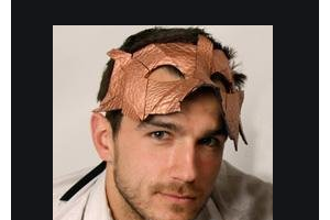 2020桂林市中醫(yī)醫(yī)院眼科整形價(jià)格表(價(jià)目表)全新發(fā)布