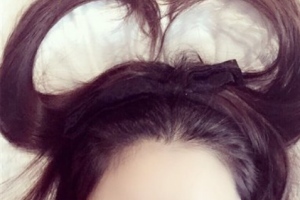 2020北京大學(xué)第三醫(yī)院整形美容外科（北醫(yī)三院）整形價(jià)格表(價(jià)目表)全新發(fā)布